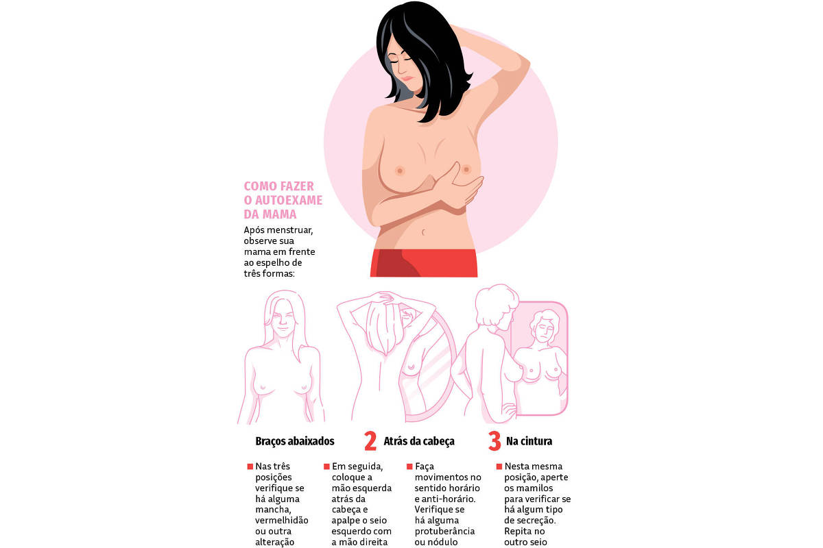 Droga moderna contra câncer de mama metastático será oferecida pelo SUS